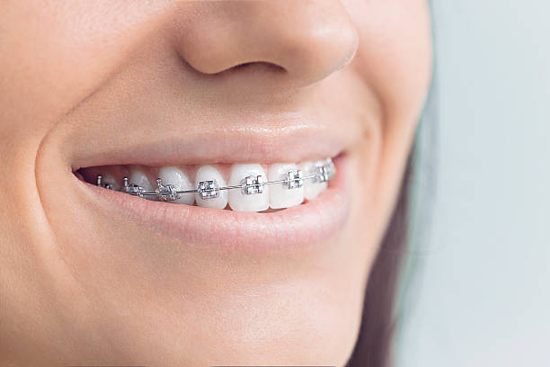 Why Choose Us for Your Dental Needs in Winslow, AZ